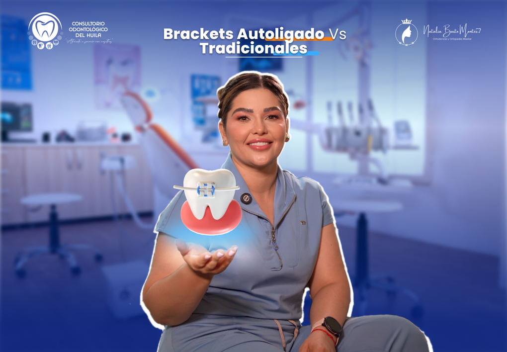 Brackets Autoligado vs Tradicionales: ¿Cambiaste un Ferrari por un Twingo?