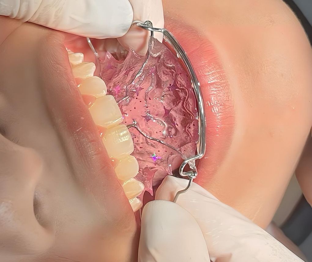 Ortodoncia en Adolescentes: Un Caso de Éxito que Refleja Disciplina y Sonrisas Personalizadas