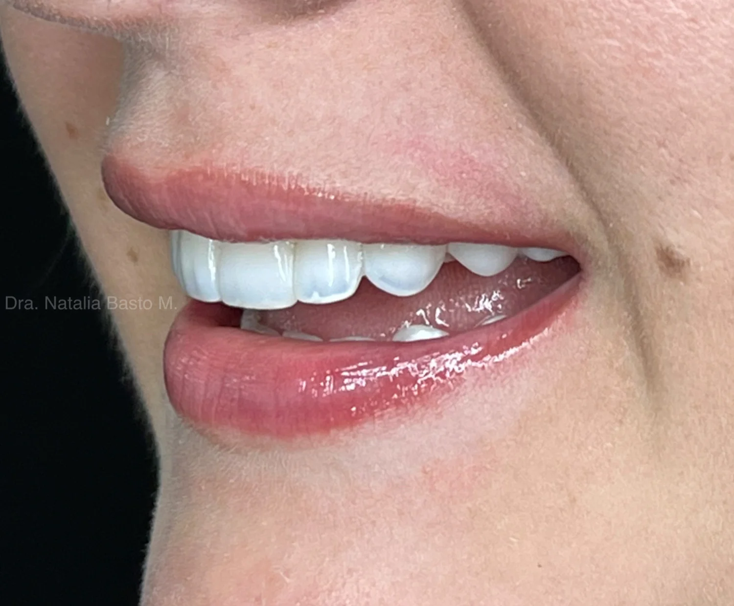 Recuperando su sonrisa después de años sin resultados